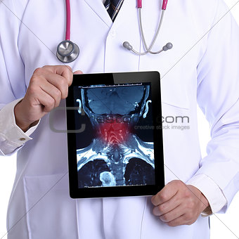 Doctor holding touch pad for Painful neck X-ray 