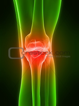 painful knee