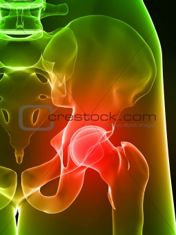 painful hip