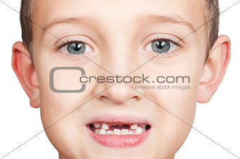 loss of primary teeth in children