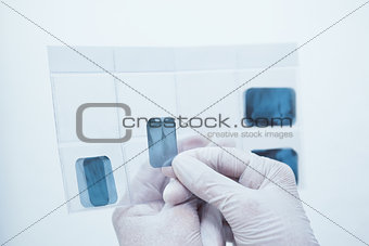 Gloved hands holding teeth x-ray
