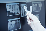 Teeth x-ray