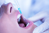 Close up of a patient with mouth open and syringe for injection