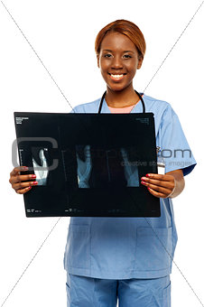 Medical expert holding patients x-ray report