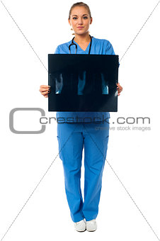 Female doctor with x-ray report