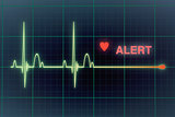Heart beats cardiogram on the monitor.