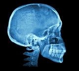 Human skull X-ray image