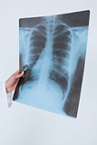 Doctor holding at X-Rays