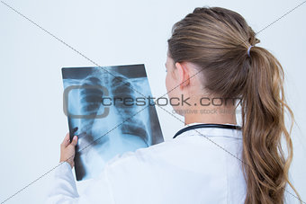 Focus doctor looking at X-Rays