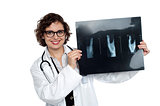 Female surgeon holding up x-ray sheet