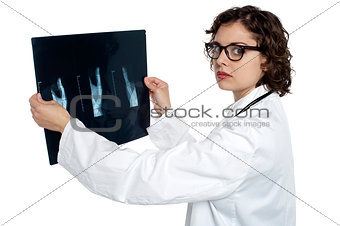 Serious female doctor showing the x-ray sheet
