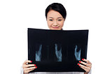 Female doctor analyzing patient's x-ray report