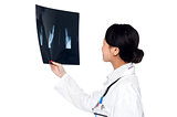 Female doctor looking at scanned x-ray report