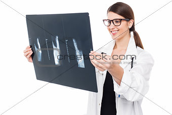Young doctor examining thumb x-ray report