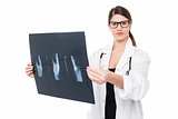 Serious faced female doctor holding up x-ray