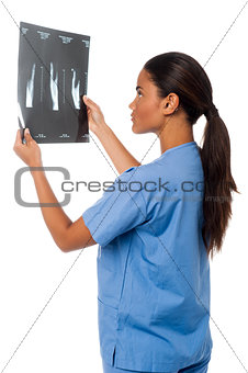 Young doctor looking at scanned x-ray report