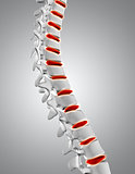3D close up of spine with discs highlighted