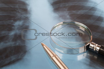 X-ray examination and pen