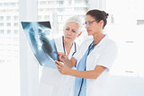 female doctors examining x-ray