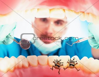 Patient with caries germs