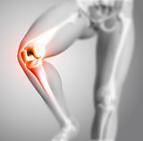 3d medical figure with close up of knee
