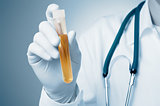 Doctor holding urine sample
