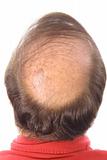 shot of a mans bald head upclose