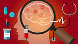 alzheimer parkinson brain cancer medication anatomy medical health care cure disease