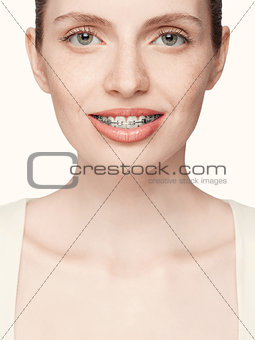 Happy beautiful girl with braces