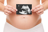 Pregnant woman holding an untrasound scan
