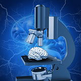 3D medical image depicting alzheimers research