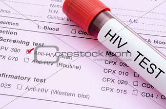 Sample blood collection tube with HIV test label.