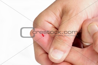 Thumb from a Bloody Finger
