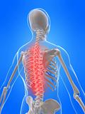 human skeletal back with pain