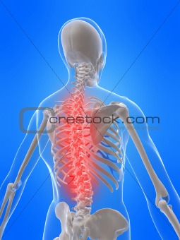 human skeletal back with pain