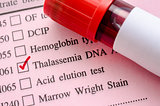 Sample blood in blood tube for Thalassemia DNA test.