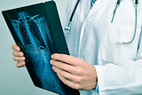 doctor observing a skeleton radiograph