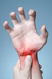 Hand with wrist pain