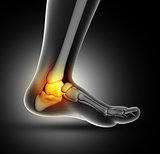 3D medical image of ankle bone