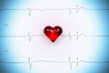 EKG heart
