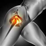 3D medical image of hip bone