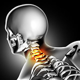 3D medical image of neck bone