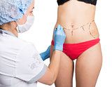 Female doctor makes dotted line on female body for cellulite correction. cosmetic surgery. lifting and breast augmentation