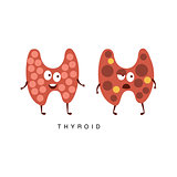 Healthy vs Unhealthy Thyroid Infographic Illustration
