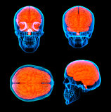 3d render human red brain X ray