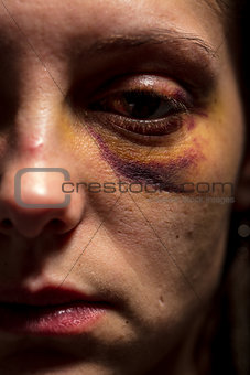 woman victim of domestic violence and abuse
