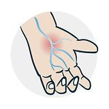 problems with veins hands icon