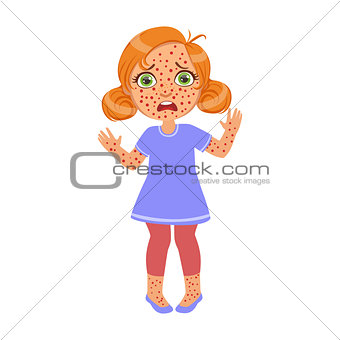 Girl With Red Pimples Rush,Sick Kid Feeling Unwell Because Of The Sickness, Part Of Children And Health Problems Series Of Illustrations