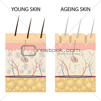 Young healthy skin and older skin comparison.