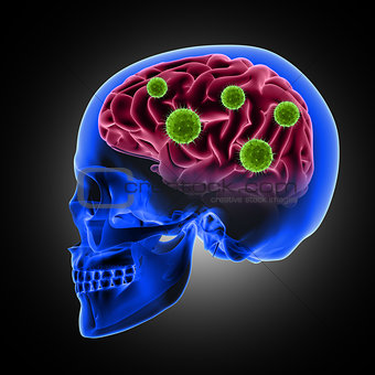 3D male skull with virus cells attacking the brain